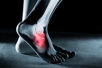 Foot Stress Fracture Symptoms