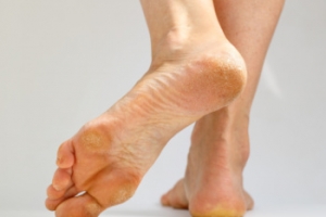 Pain in the Bottom of the Foot